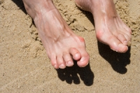 Hammertoe and How to Find Relief