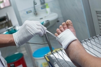 Strategies for Healing Diabetic Foot Ulcers