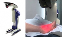What Are the Benefits of MLS Laser Therapy?