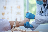Facts About Ankle Fractures
